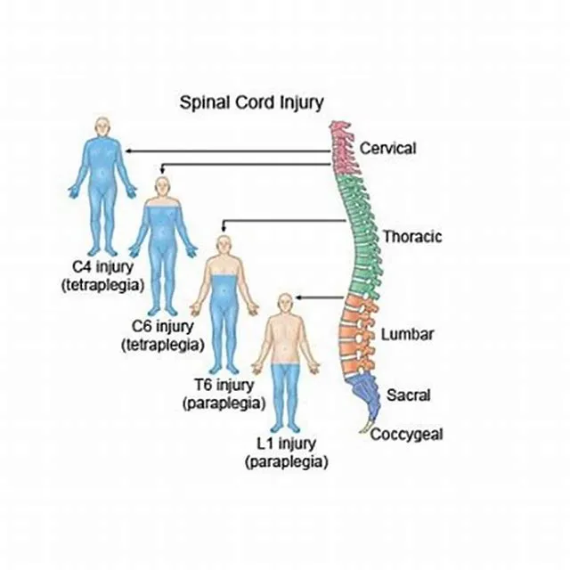 Physician (Spinal Cord Injury And Disorders) job opening at Veterans Health Administration