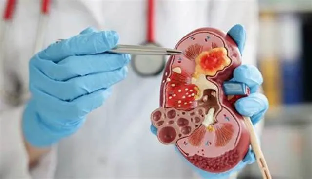 Nephrologist job opening at Veterans Health Administration